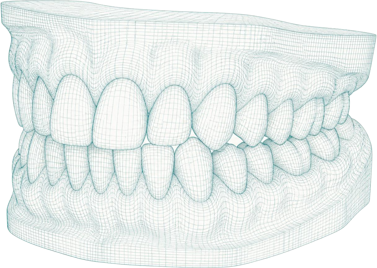 3D-Modell eines digitalen Kieferscans